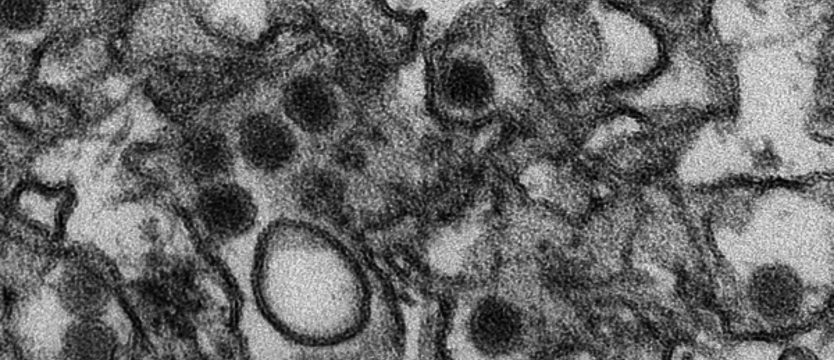 Czy zagraża nam wirus Zika?