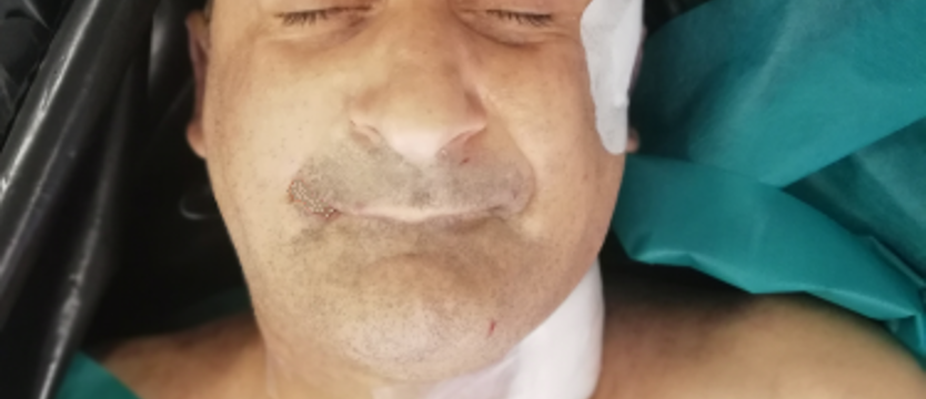 Kto rozpoznaje tego mężczyznę?