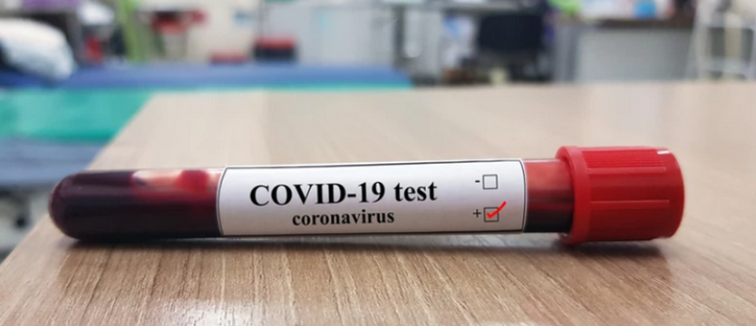 Testy na koronawirusa w Wojewódzkiej Stacji Sanitarno-Epidemiologicznej w Szczecinie
