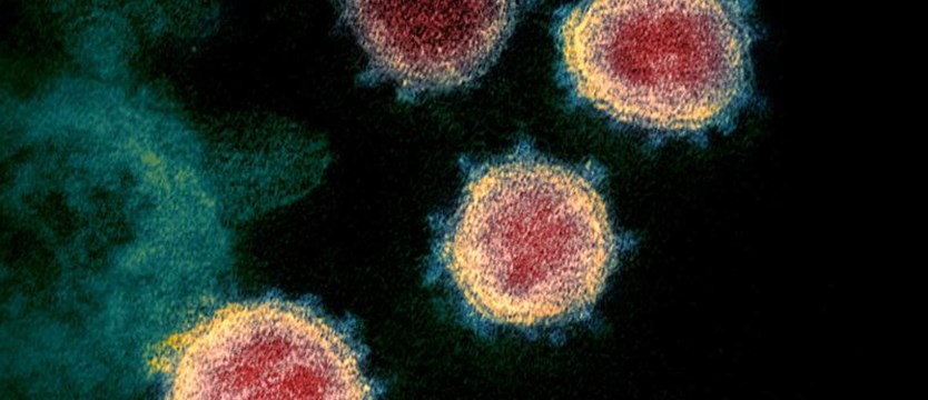 Osiem nowych przypadków koronawirusa w Zachodniopomorskiem. Łącznie 89 zakażonych