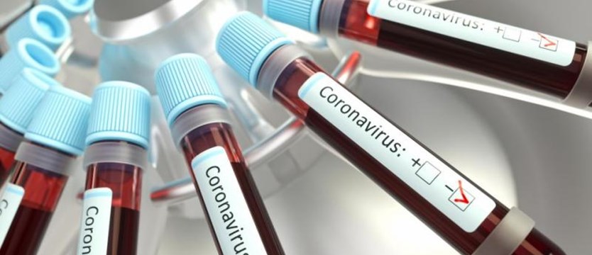 W kraju 205 nowych zakażeń koronawirusem. Zmarły 23 osoby