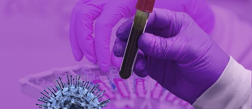 Pierwszy polski test na koronawirusa wejdzie do produkcji w przyszłym tygodniu