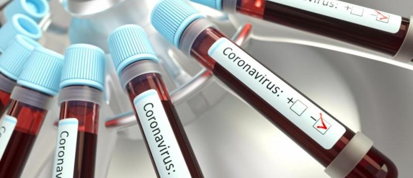 Ponad 500 zakażonych koronawirusem w Zachodniopomorskiem