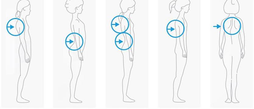 Rośnie garbate pokolenie