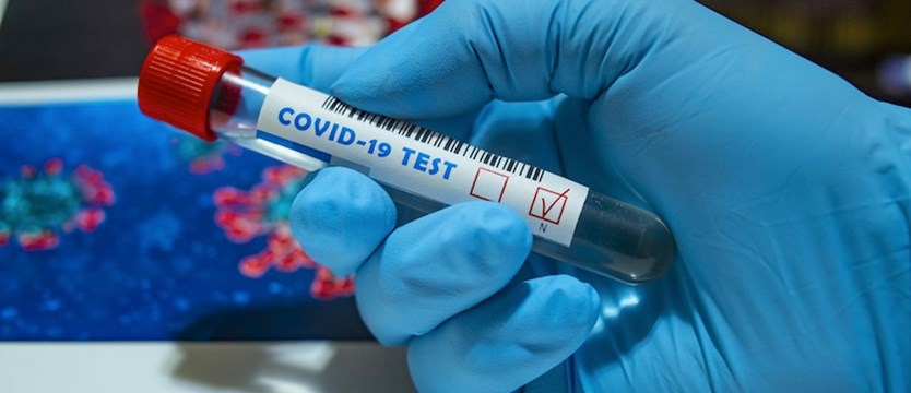 Lekarze opracowali superszybki test na koronawirusa