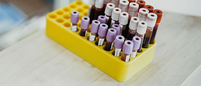 Cztery osoby, w tym dziecko z koronawirusem w regionie