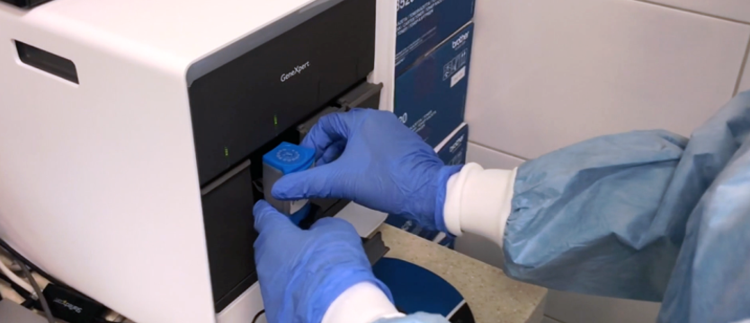 572 nowe przypadki koronawirusa w naszym województwie