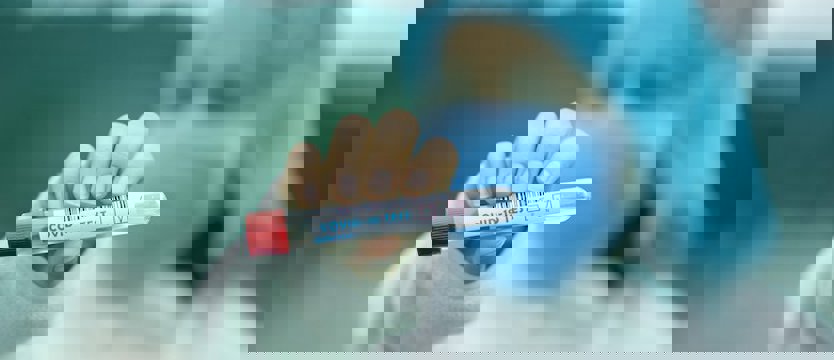 W kraju 86 nowych przypadków koronawirusa. W regionie potwierdzono cztery zakażenia