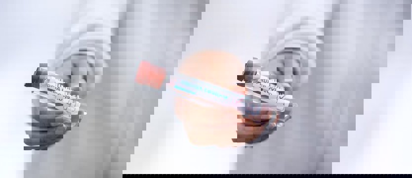 W kraju w środę 882 zakażenia wirusem SARS-CoV-2. Zmarło 20 osób