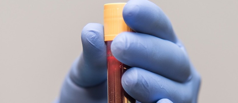 Ministerstwo Zdrowia: 33 480 nowych przypadków koronawirusa. Zmarły 33 osoby