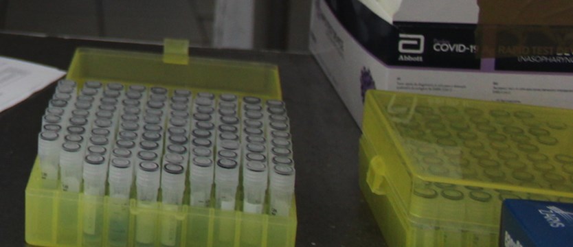 W środę 36 nowych przypadków koronawirusa w regionie. Nikt nie umarł