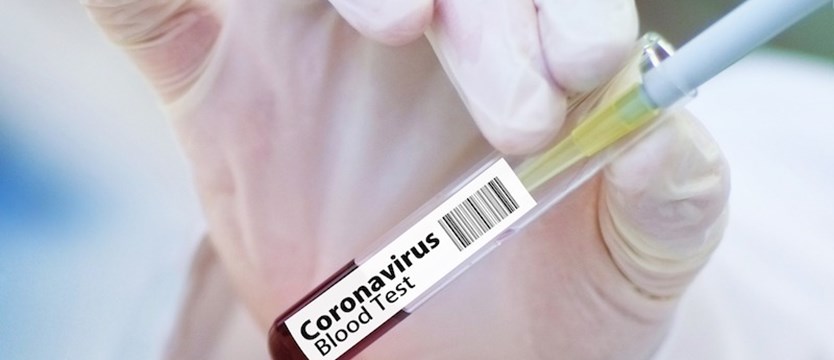 W czwartek w kraju spadek liczby przypadków koronawirusa, a w regionie lekki wzrost